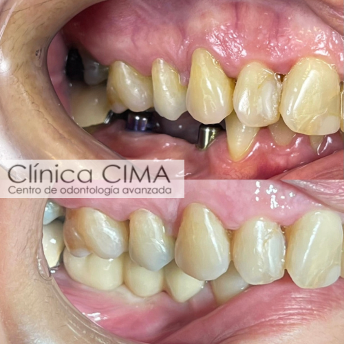 Clínica CIMA Implantología Centro de Odontologia Avanzada