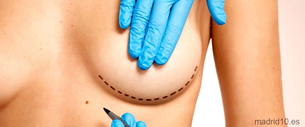 19 Mejores cirujanos de abdominoplastia en Madrid