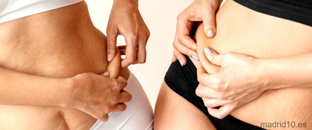 17 Mejores clínicas de liposucción en Madrid