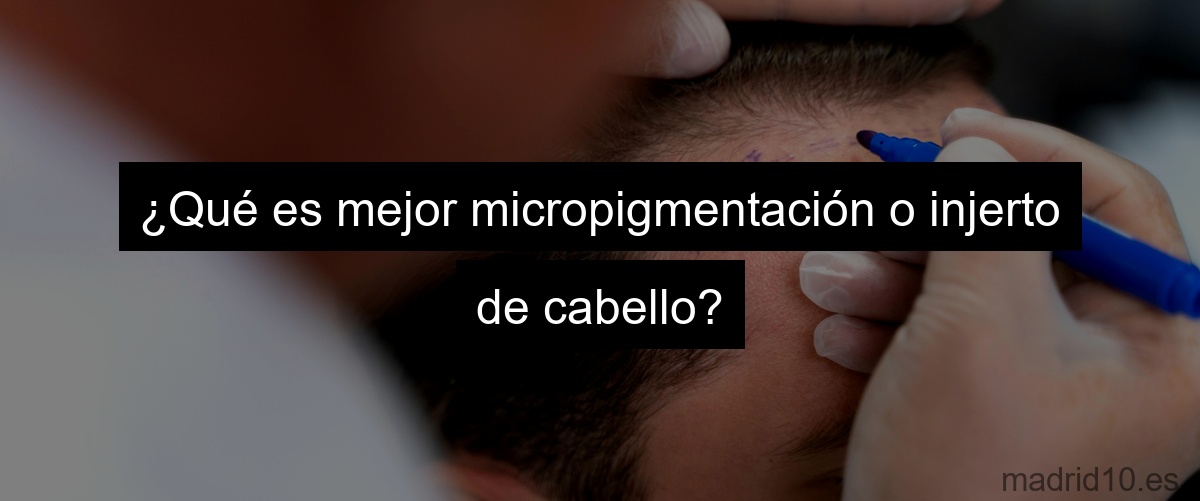 ¿Qué es mejor micropigmentación o injerto de cabello?