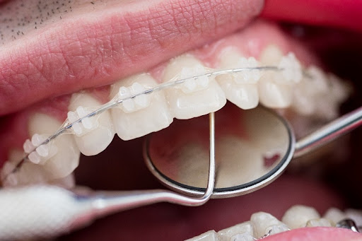 Clínica Dental Acacias