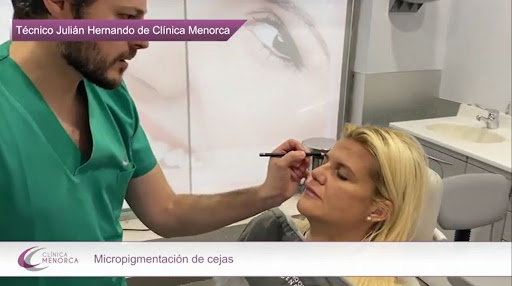 Micropigmentacion-Microblading de cejas-ojos. Clínica Menorca. Madrid
