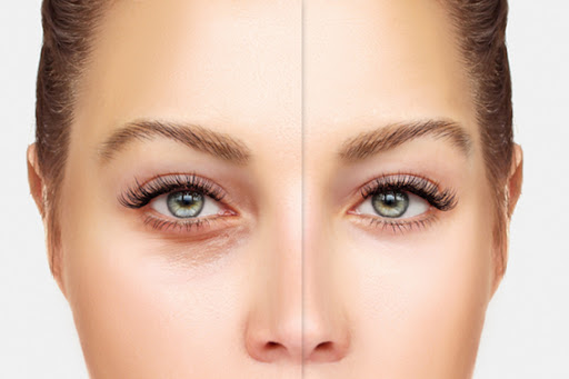 Cirugía plástica ocular, estética y correctiva: – Instituto